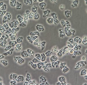 Phase contrast microscopy of amoeba