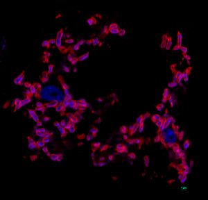 Confocal microscopy of amoeba organelles.